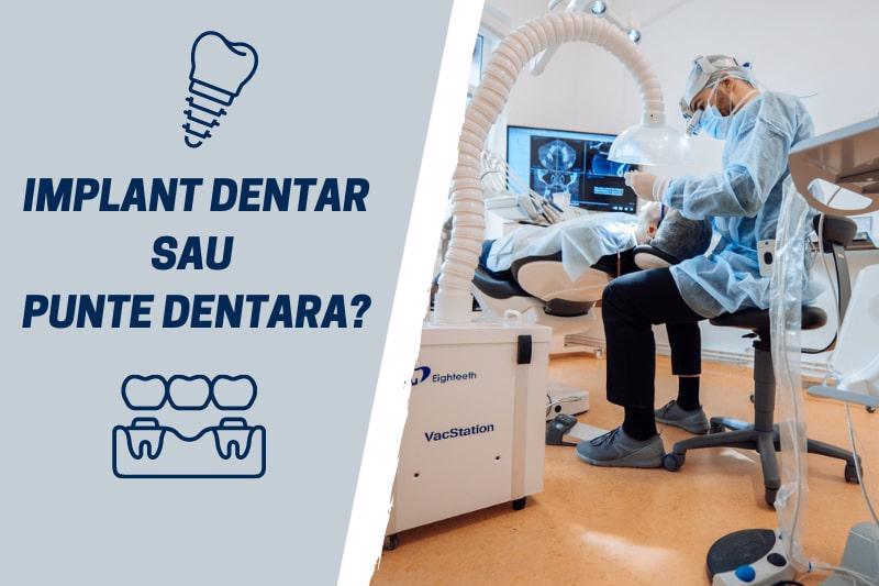 Ce sa alegi atunci cand ai un dinte lipsa - implant dentar sau punte dentara?
